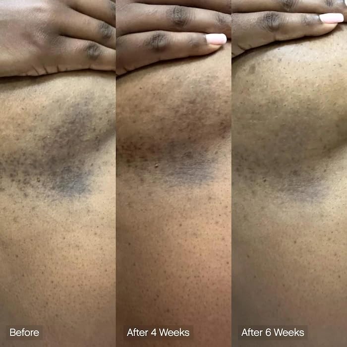 Faded Cleansing Bar for Face and Body | Kojic Acid, Vitamin C & Lactic Acid | Moisturizes | Vegan, Fragrance-Free, Safe for Sensitive Skin (2 Pack)