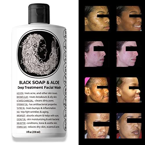 Natural Black Soap with Aloe | Helps With Bumps Dark Spot for Face Paraben Free | All Natural Ingredients Liquid Soap