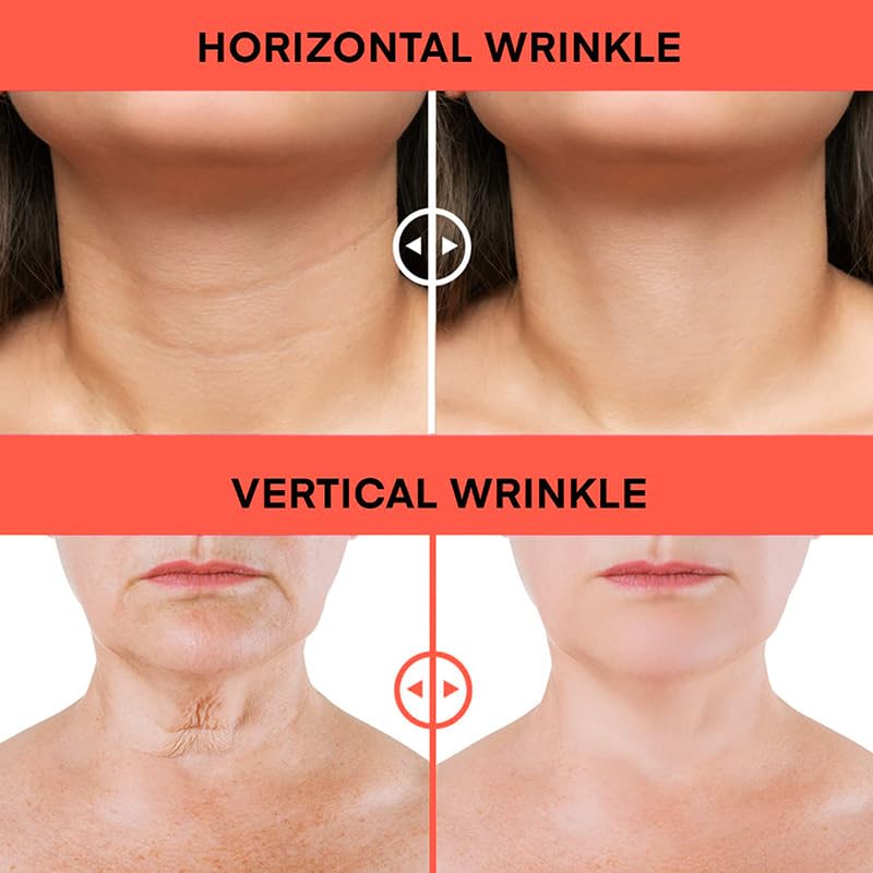 Retinol Face & Neck Cream – Anti-Aging, Firming & Tightening with Collagen & Hyaluronic Acid, Instant Lift & Wrinkle Repair, 3.4 fl. oz