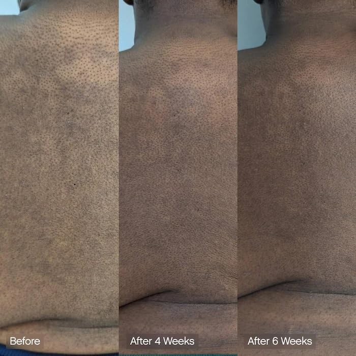 Faded Cleansing Bar for Face and Body | Kojic Acid, Vitamin C & Lactic Acid | Moisturizes | Vegan, Fragrance-Free, Safe for Sensitive Skin (2 Pack)