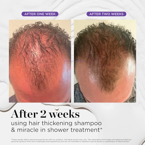 Dr. Groot Hair Thickening Shampoo with Biotin & Rosemary Oil – Volumizes Thinning Hair, Hydrates Scalp & Strengthens Damaged Hair, Korean Formula