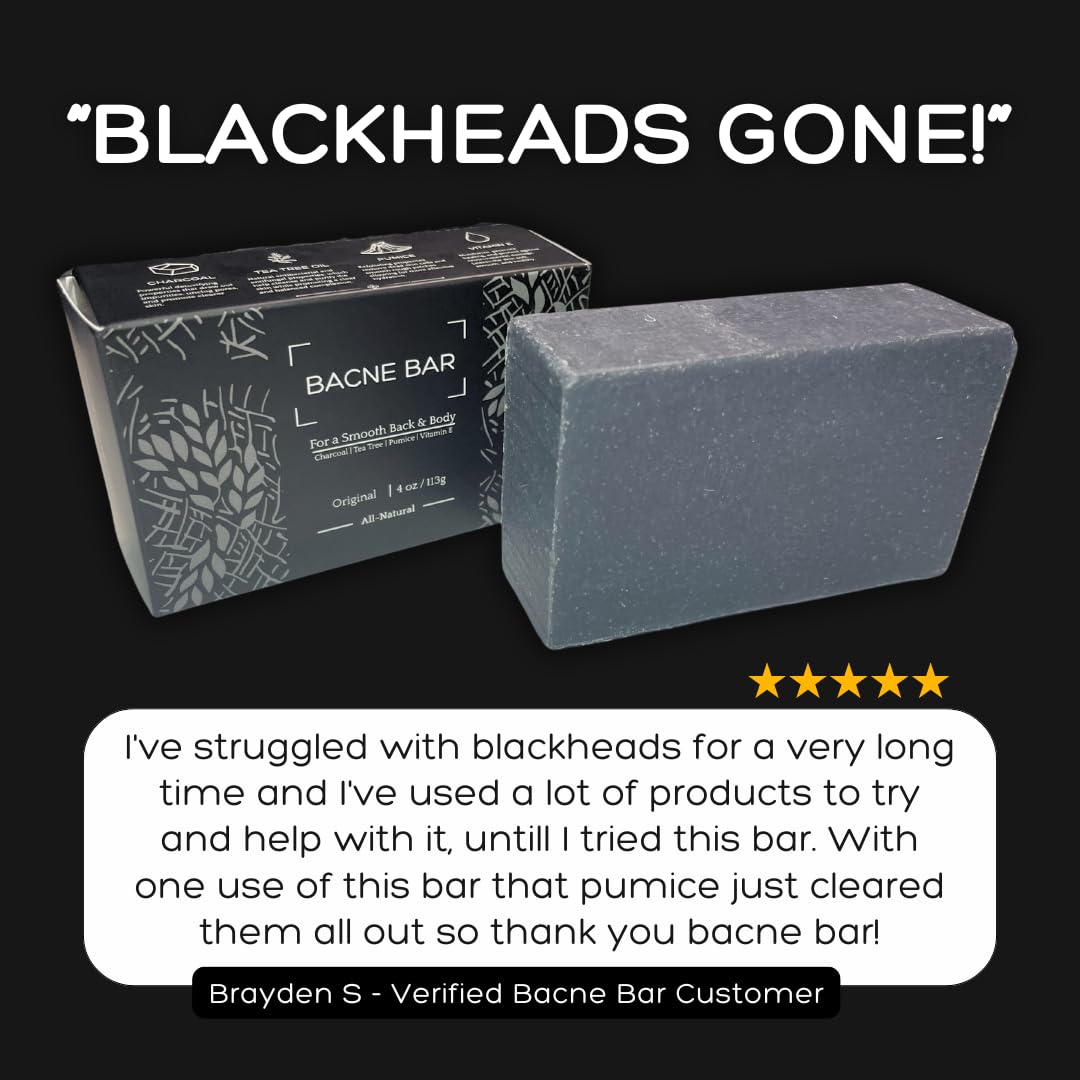 Bacne Bar – All-Natural Back Acne Soap with Charcoal, Pumice, Tea Tree & Vitamin E for Deep Exfoliation, Not for Sensitive Skin