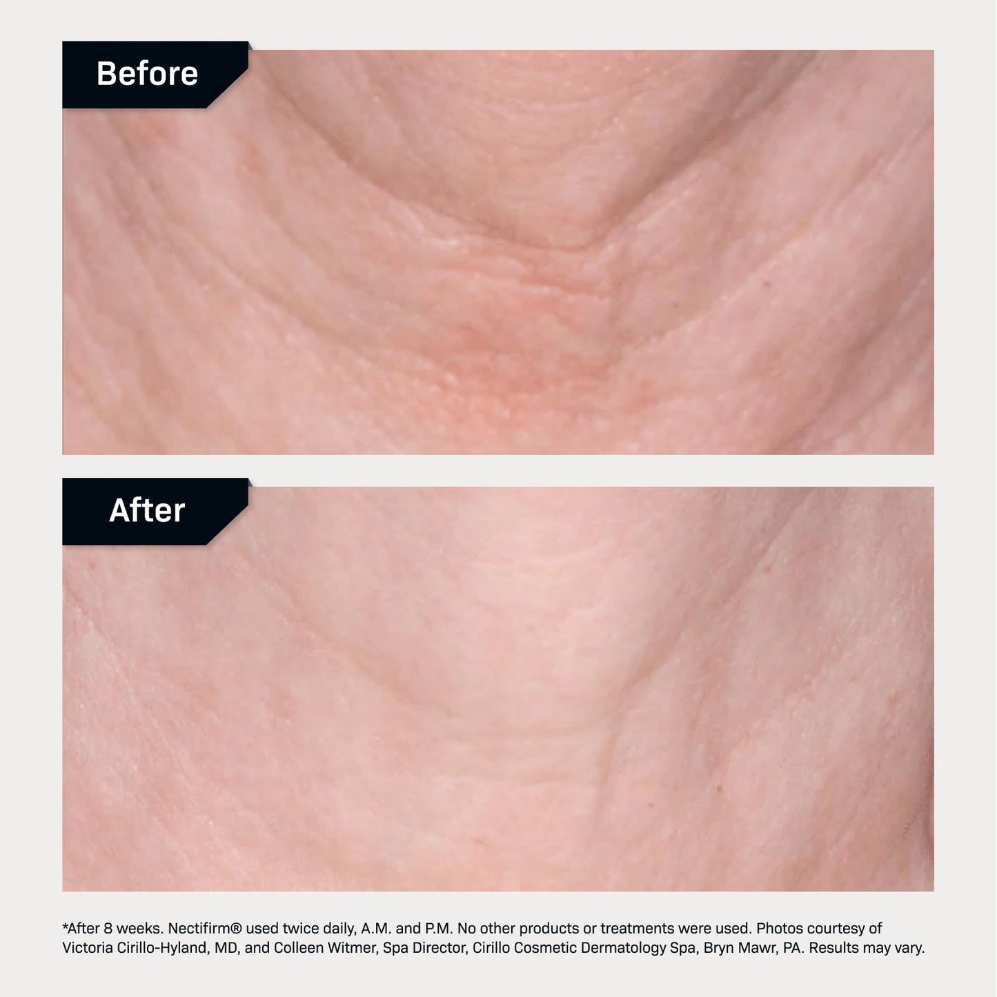 Revision Skincare Nectifirm®, Anti Aging Neck Firming Cream for Reducing Fine Lines, Wrinkles and Crepey Skin, 1.7 oz