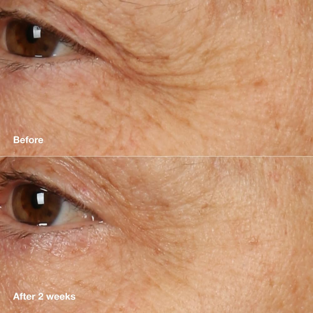 Clinique Smart Clinical Repair Anti-Aging Overnight Face Cream & Mask, Hydrating, Repairs Lines & Wrinkles, All Skin Types, 1.7 fl oz