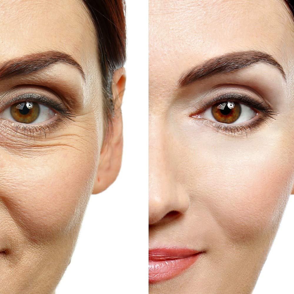 Anti-Aging Eye Gel for Dark Circles, Puffiness & Wrinkles – Firming, Hydrating with Hyaluronic Acid & Aloe Vera, 1.7 fl. oz.