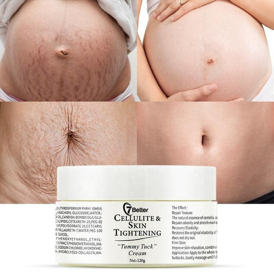 Stretch Marks and Scars Removal Cream for Pregnancy - Scars Repair, Abdominal Firming, and Gentle Stretch Marks Eradication Skincare Body