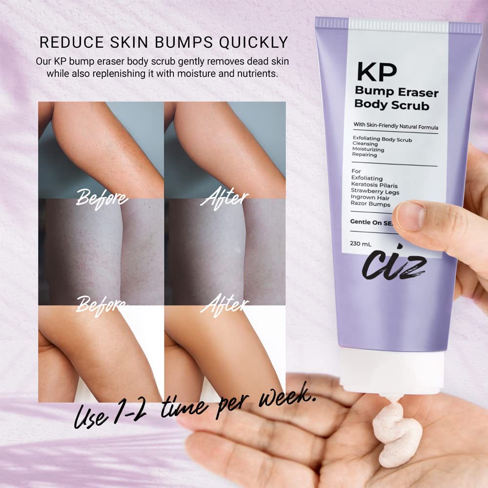 BellamiLuxx KP Bump Eraser Body Scrub – Exfoliates Keratosis Pilaris & Strawberry Skin, Smooths Rough, Bumpy, Dry Skin, Reduces Ingrown Hairs