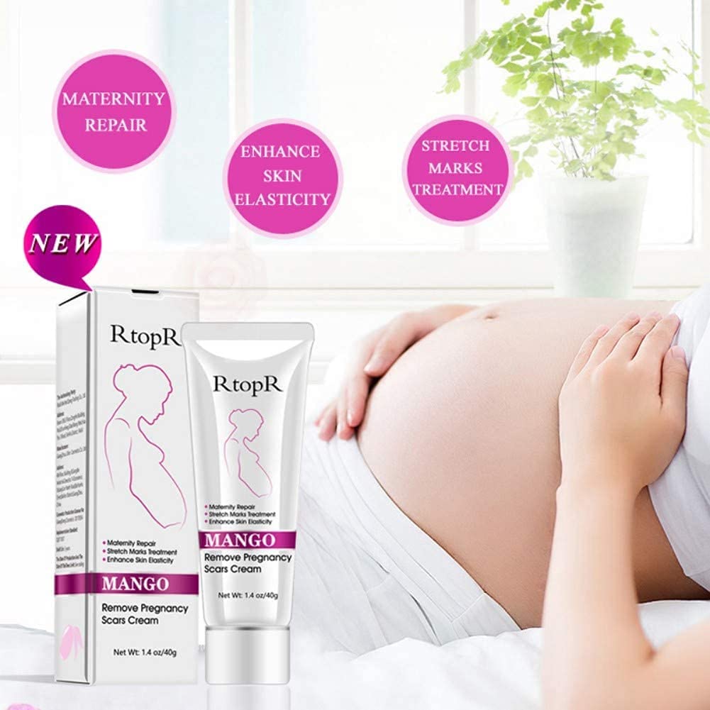 RtopR Mango Stretch Marks and Scar Cream -Stretch Marks and Scar Removal Cream for Pregnancy - Best Body Moisturizer-40g