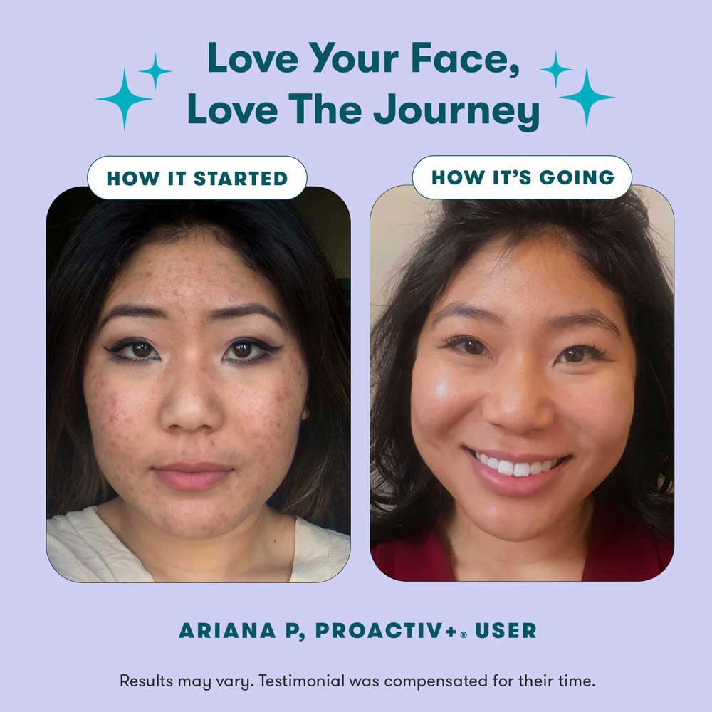 Proactiv+ 3-Step Advanced Acne Skincare Kit – Salicylic Acid Wash, Benzoyl Peroxide Treatment & Moisturizer, 30-Day Set