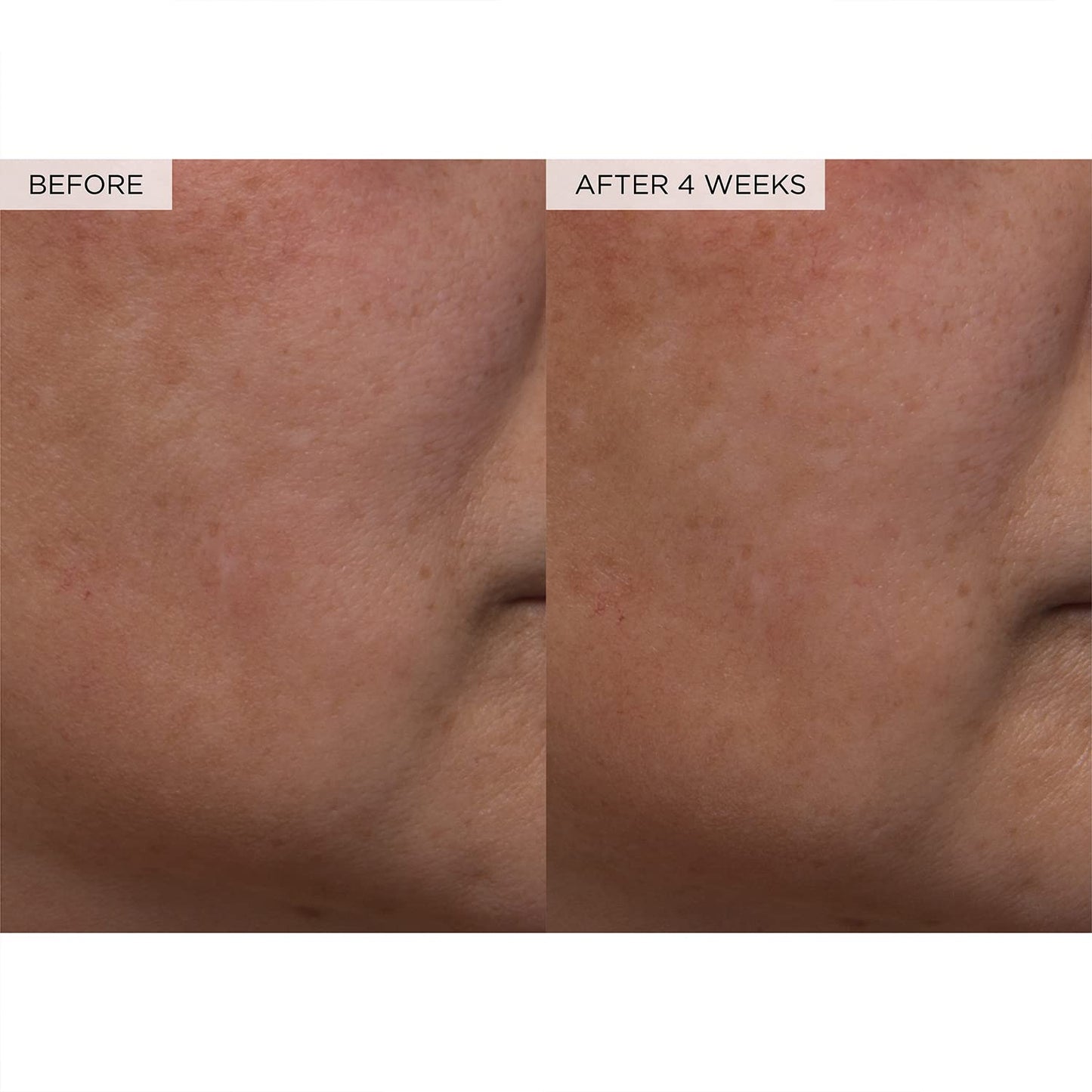 Glow Recipe PHA + BHA Face Toner – Korean Skincare, Pore Minimizer & Gentle Exfoliator with Watermelon & Cactus Water, 150ml