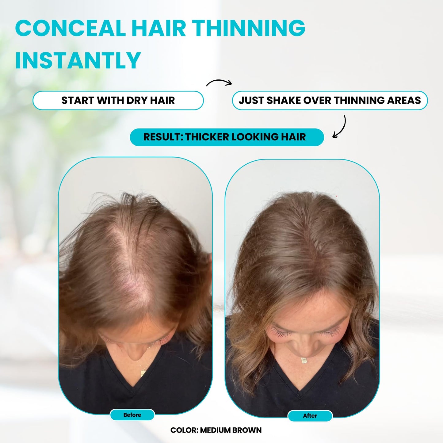 SURETHIK Hair Fibers, 15g (Dark Brown), Fills Thinning Hair for Visibly Fuller Look, Conceals Bald Spots, Natural Look, For Men & Women