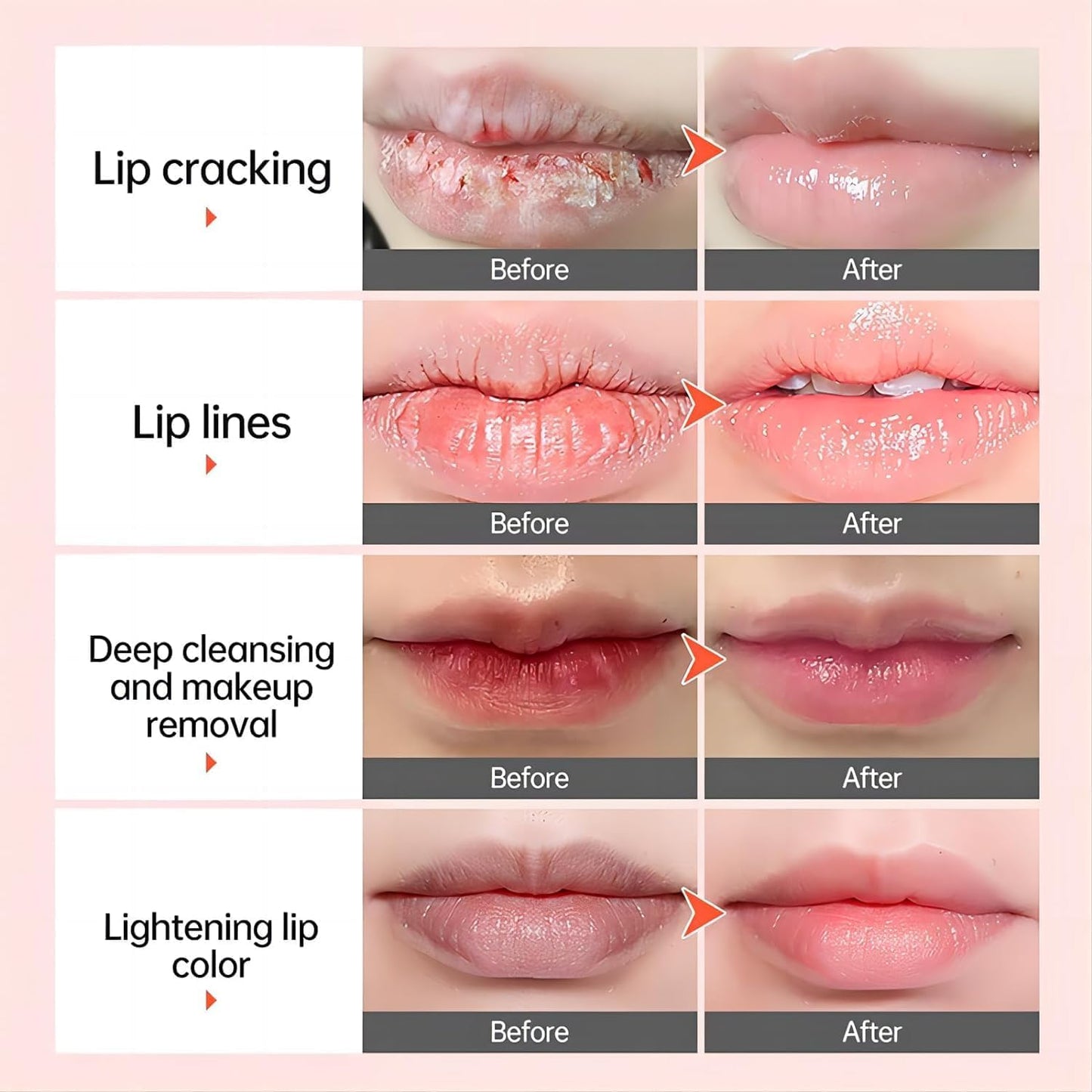 Lips Pink Fresh Lightening Repair Remove Dark Smoke Lips Lip Balm Improve dark lips Moisturizing Nourishing Lip Care