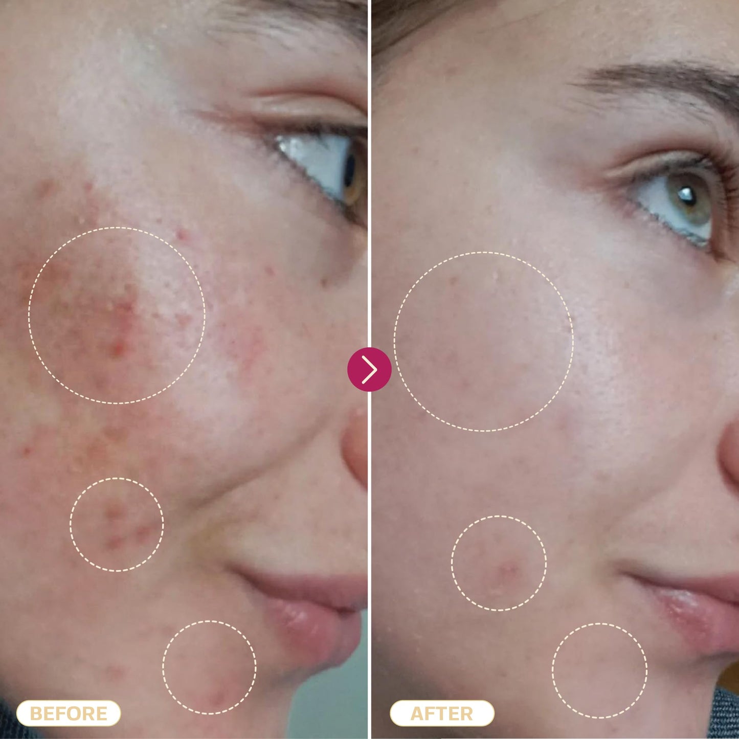 BASE LABORATORIES Hypochlorous Acid Spray for Face & Skin, 8 oz – Daily Repair for Sensitive Skin, Redness, Irritations, Acne & Eczema