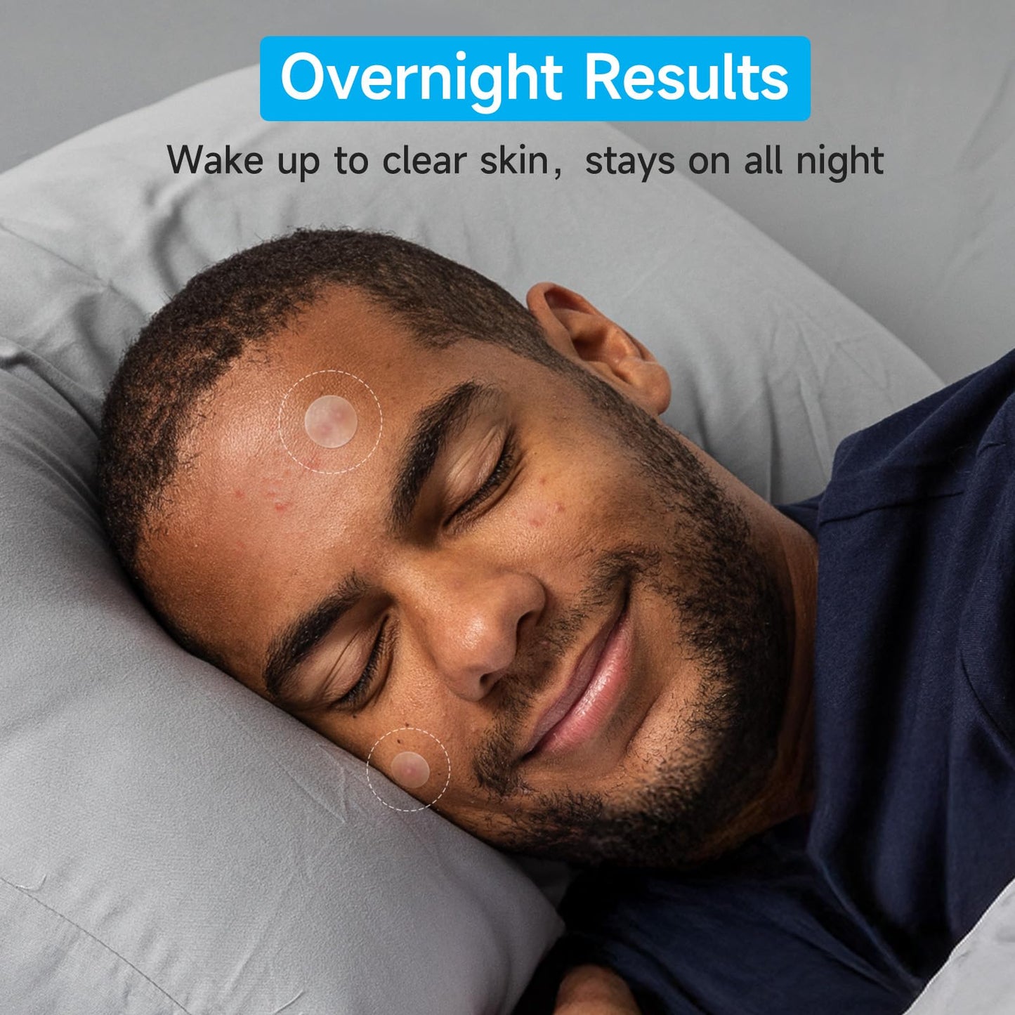 Glowpatch Pimple Patches for Face – 504 Hydrocolloid Acne Spots, 4 Sizes, Clear Zit & Blemish Stickers, FSA Eligible Bulk