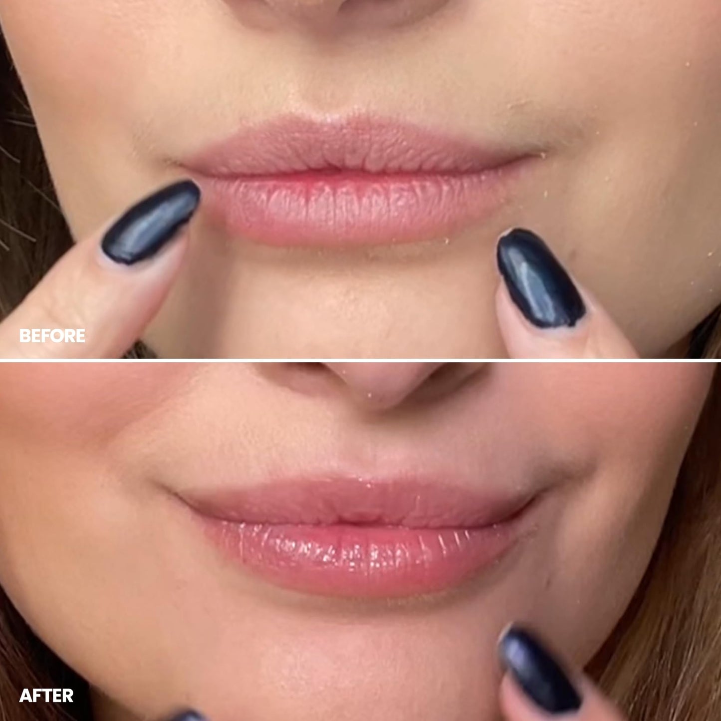 Wonderskin 3-in-1 Lip Scrub & Balm – Exfoliator, Moisturizer & Hydrator for Smooth, Soft, Flake-Free Lips, One-Step Lip Care, 0.10 oz