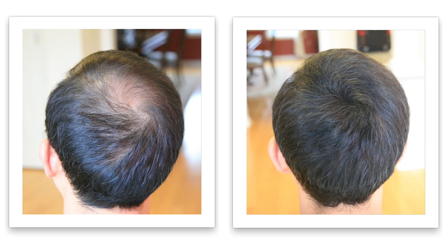 Caboki 10X Volumizing Hair Powder for Thinning Hair: Root Touch Up for Men and Women, Fill in Hairline & Edges, Cover Bald Spots. TALC-Free, Dark Gray