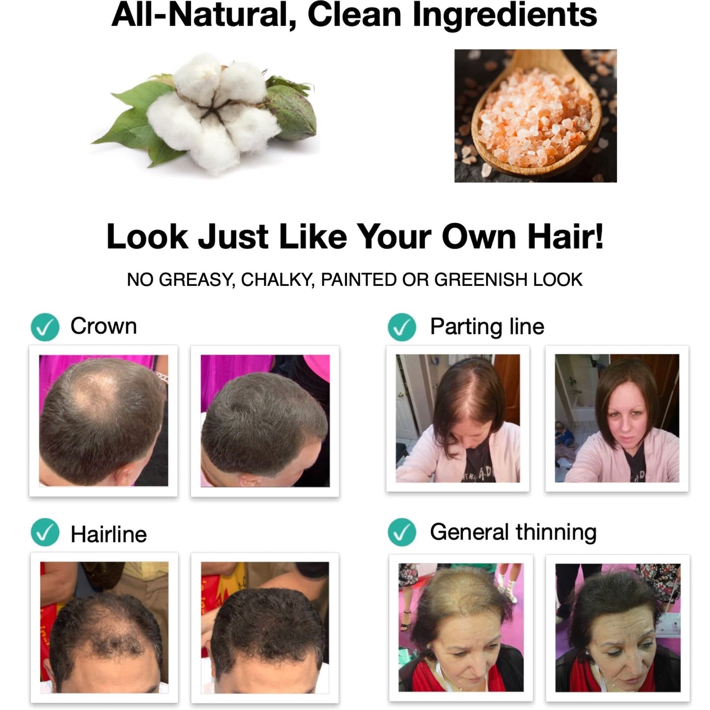 Caboki Hair Building Fiber + Built-in Spray Applicator (30-50 Days Supply). Black