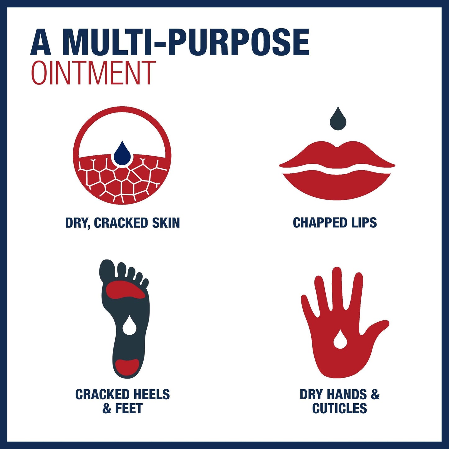 Aquaphor Healing Ointment Advanced Therapy Skin Protectant, Dry Skin Body Moisturizer, 7 Oz Tube