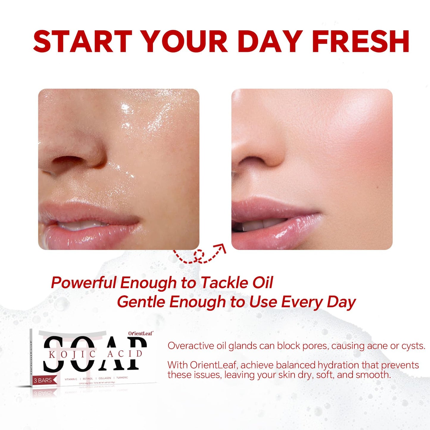 ORIENTLEAF Kojic Acid & Turmeric Soap 3-Pack – Brightening Bar for Dark Spots, Face & Body, Vitamin C, Shea Butter & Collagen