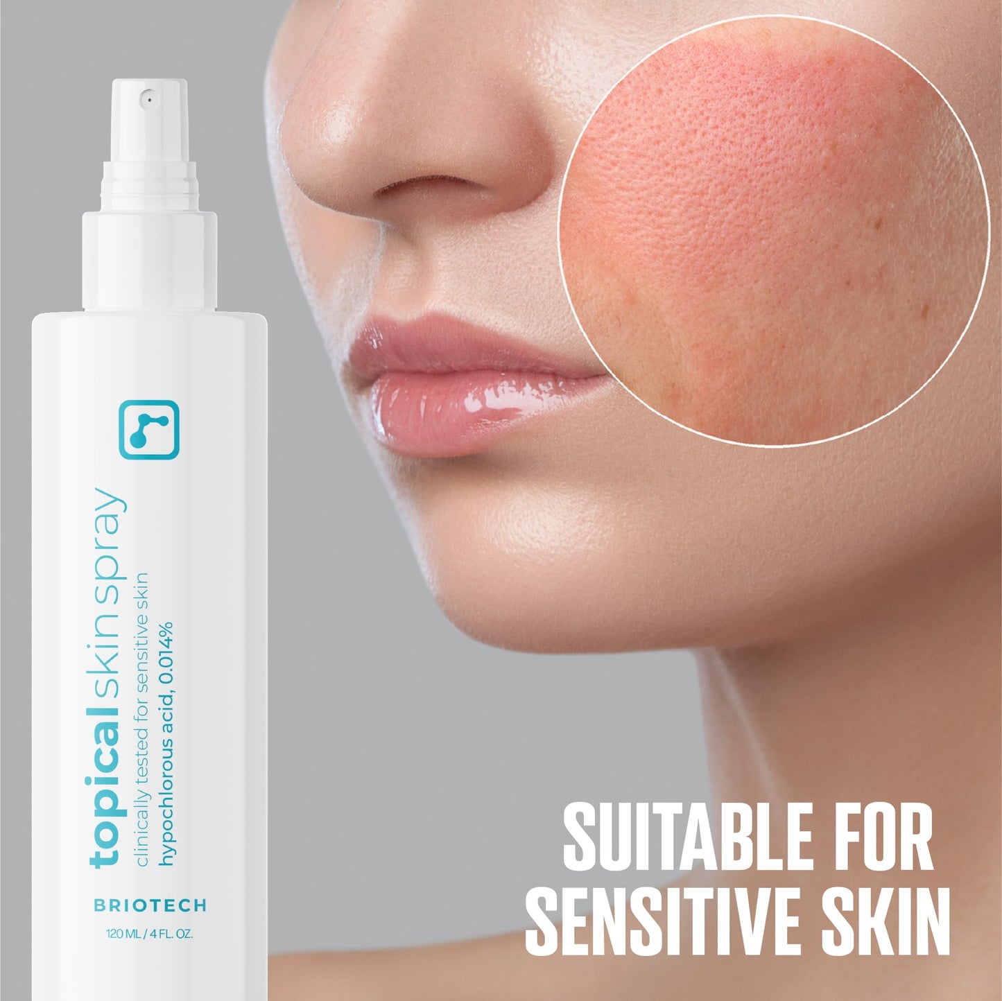 BRIOTECH Hypochlorous Acid Skin Spray – HOCl Facial & Body Mist for Sensitive Skin, Soothes Redness, Irritation, Feet & Scalp, 4 oz