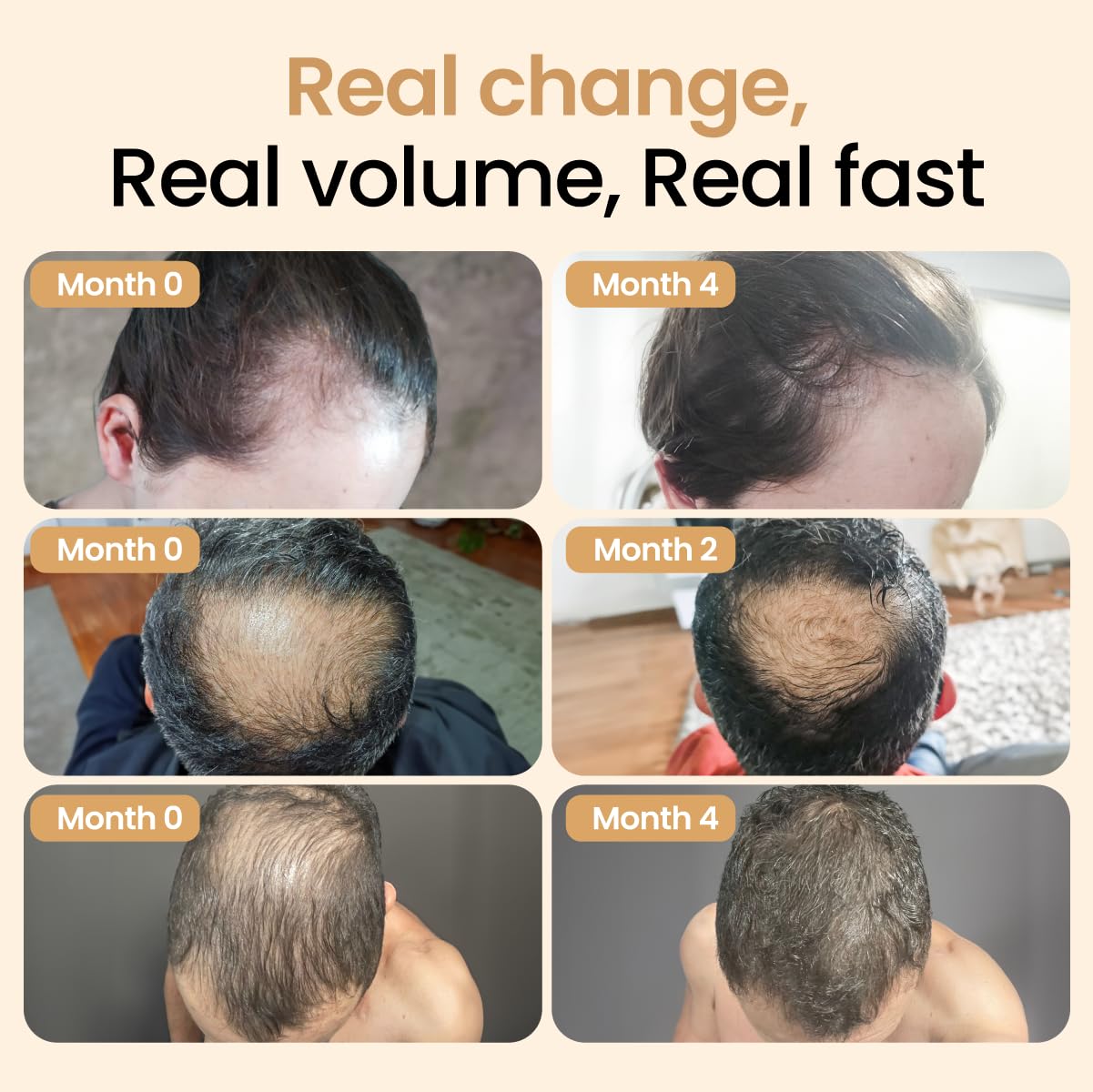 Hair Booster Serum for Women & Men – Peptide-Enriched Hair Tonic with Capilia Longa & Arginine for Thick, Strong, Revitalized Hair – 2 Fl Oz, 3 Pack