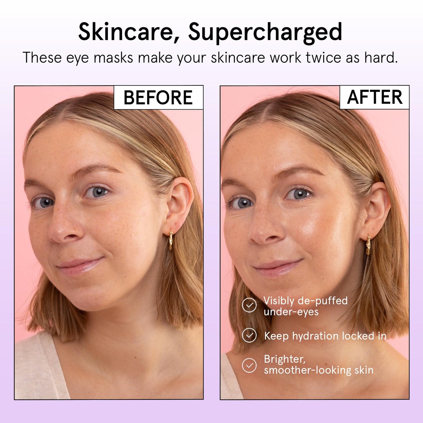 Grace & Stella Reusable Silicone Eye Patches for Dark Circles, Puffy Eyes Treatment, 1 Pair with Tin Case, Vegan & Cruelty-Free