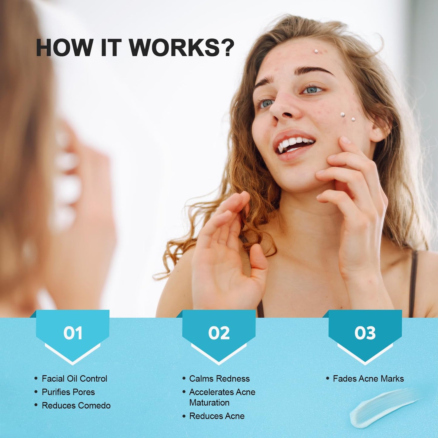 Acne & Pimple Spot Treatment Cream with 10% Azelaic Acid – Blemish, Blackhead & Cystic Acne Remover for Face, Back & Body, 1.8 oz