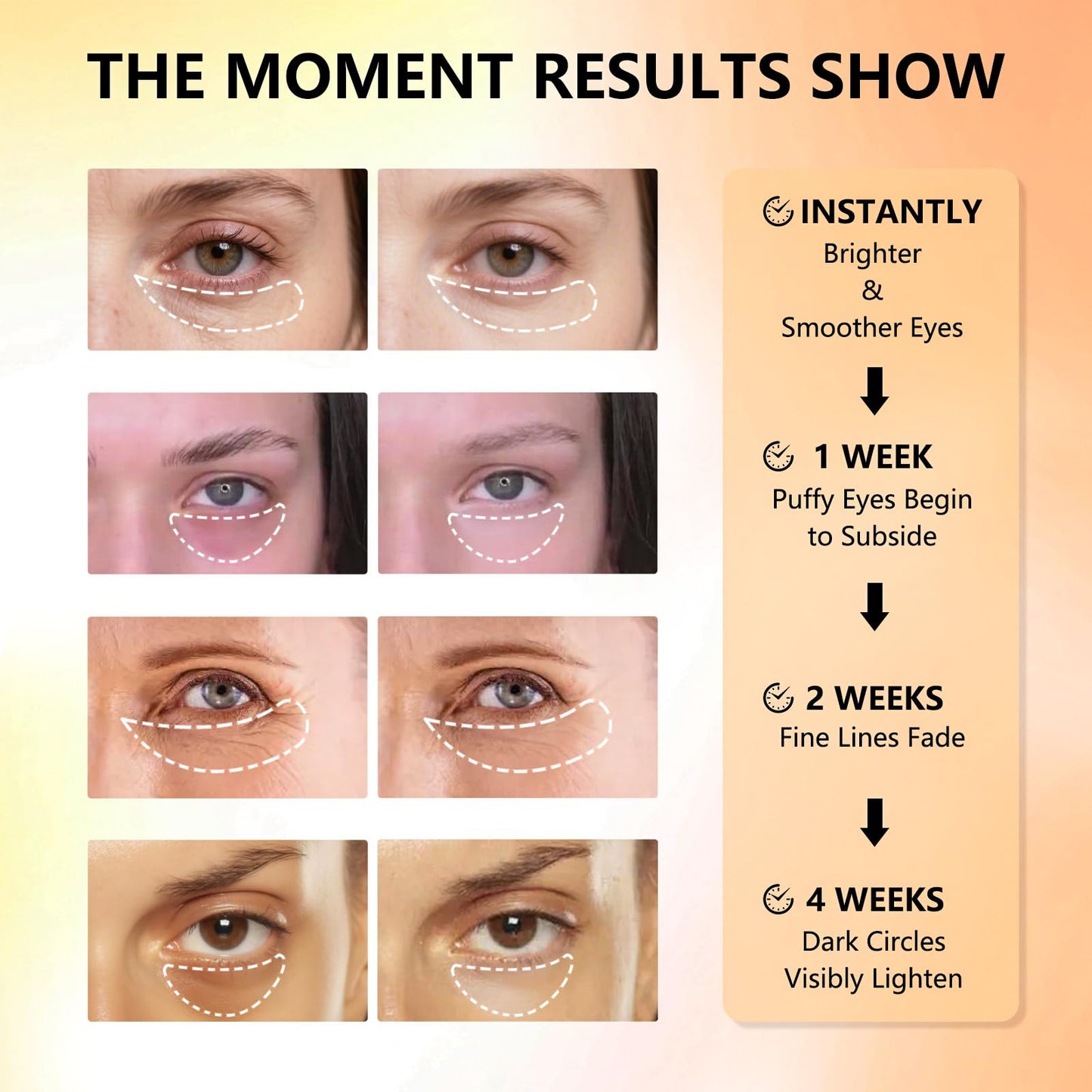 Aeryea Vitamin C & Caffeine Under Eye Patches, 30 Pairs – Reduce Dark Circles, Puffiness & Fine Lines with Niacinamide Collagen