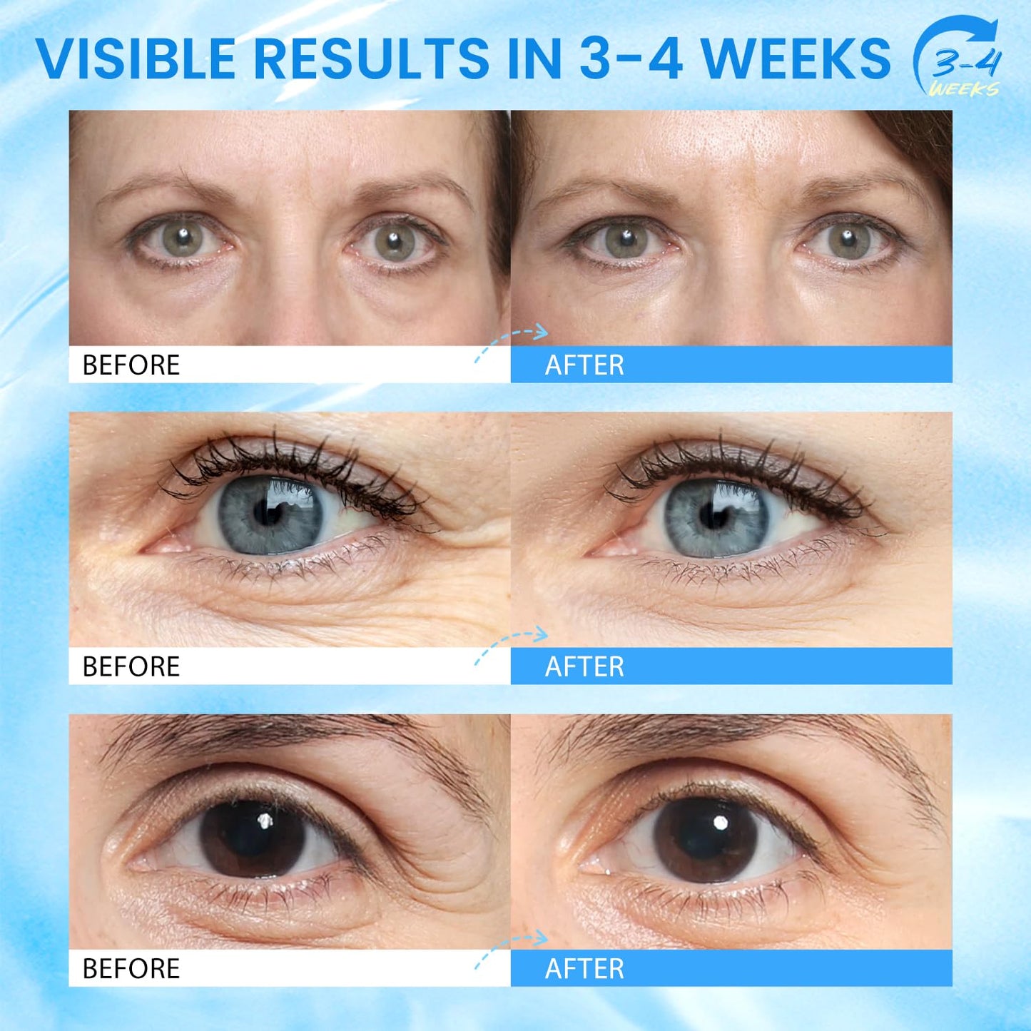 RONKIE Caffeine Eye Cream for Dark Circles: Caffeine Eye Stick - Smooth Fine Lines and Hydrate Eye Area