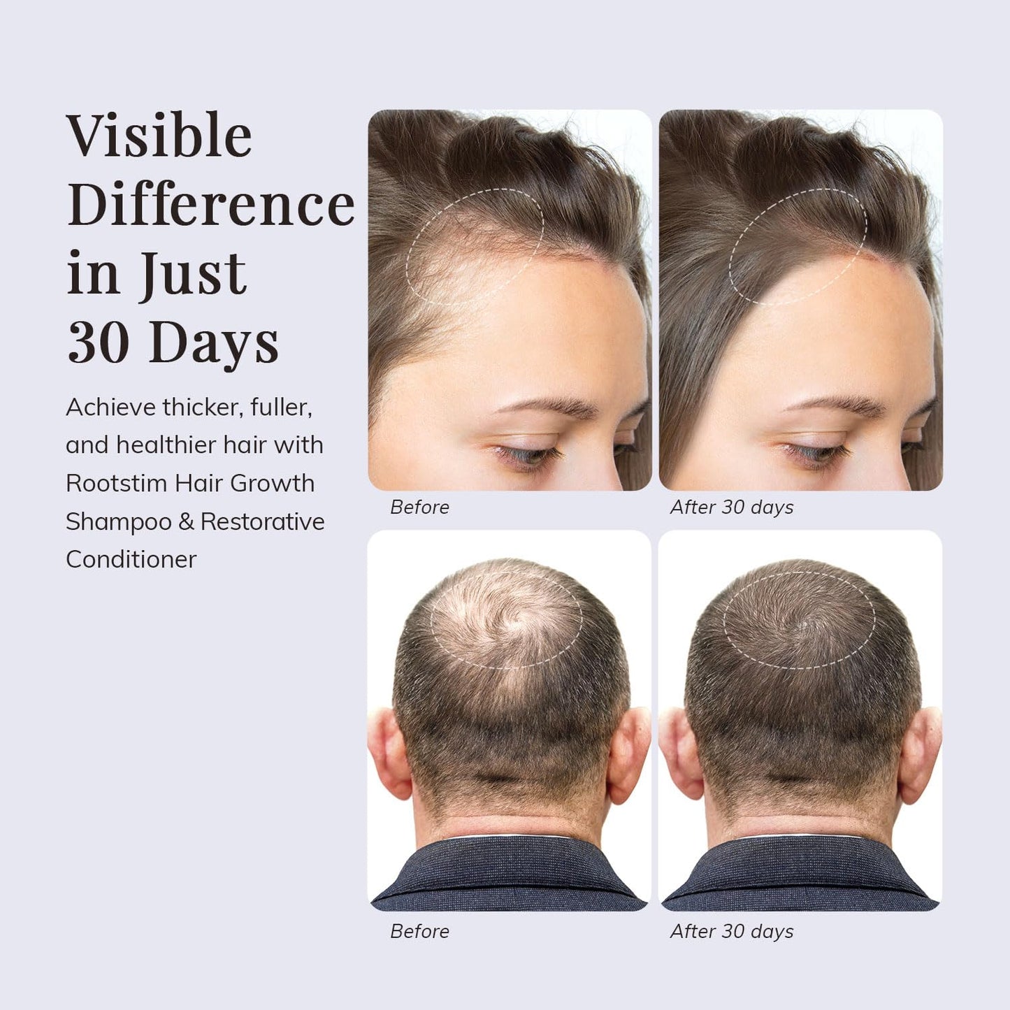 Rosemary & Biotin Hair Growth Shampoo and Conditioner Set – Thickening, Strengthening & Nourishing Formula for a Healthy Scalp and Fuller Hair