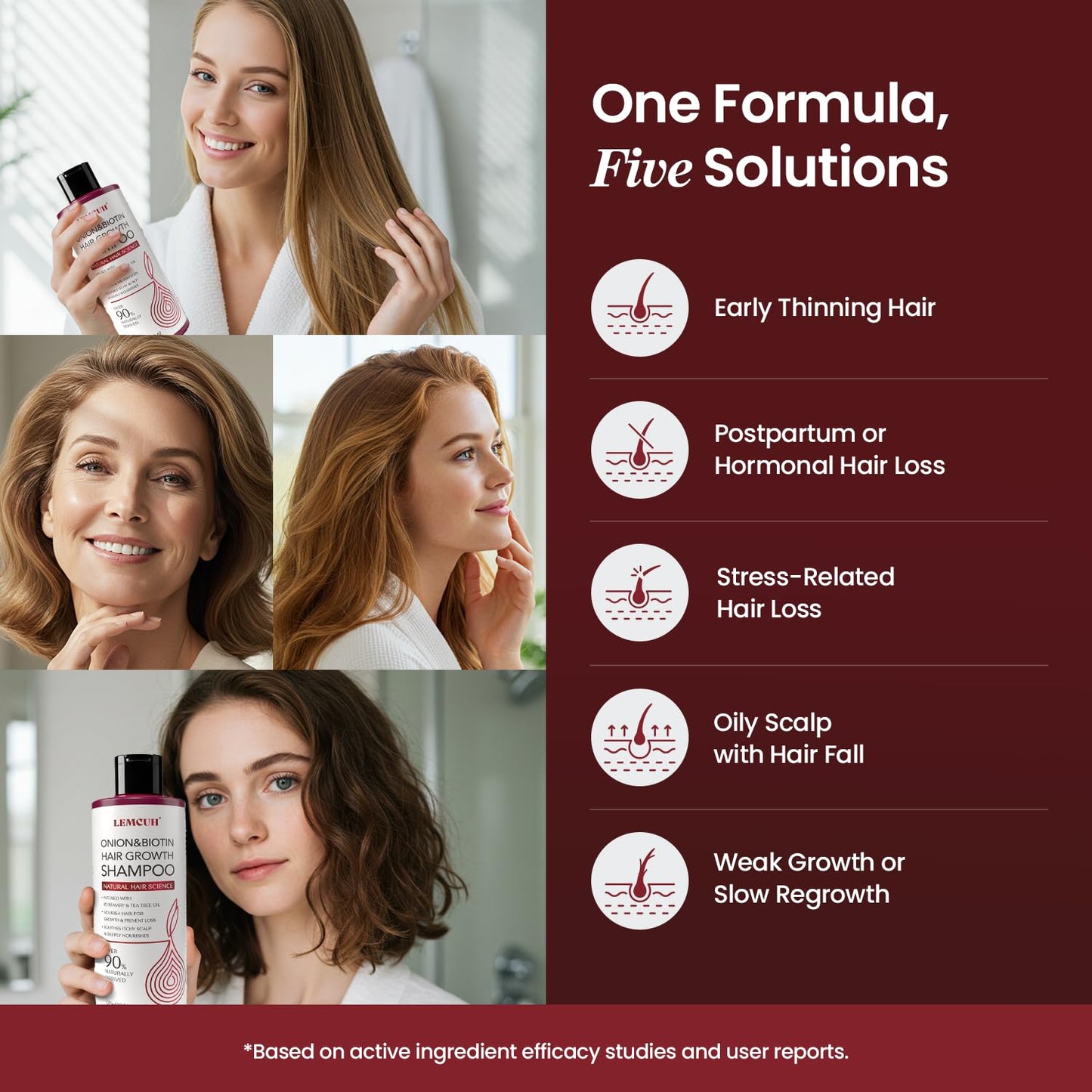 Onion & Biotin Hair Growth Shampoo with Rosemary & Tea Tree Oil – Anti Hair Loss & Thickening Formula for Strong, Healthy Hair (12.5 Fl Oz)