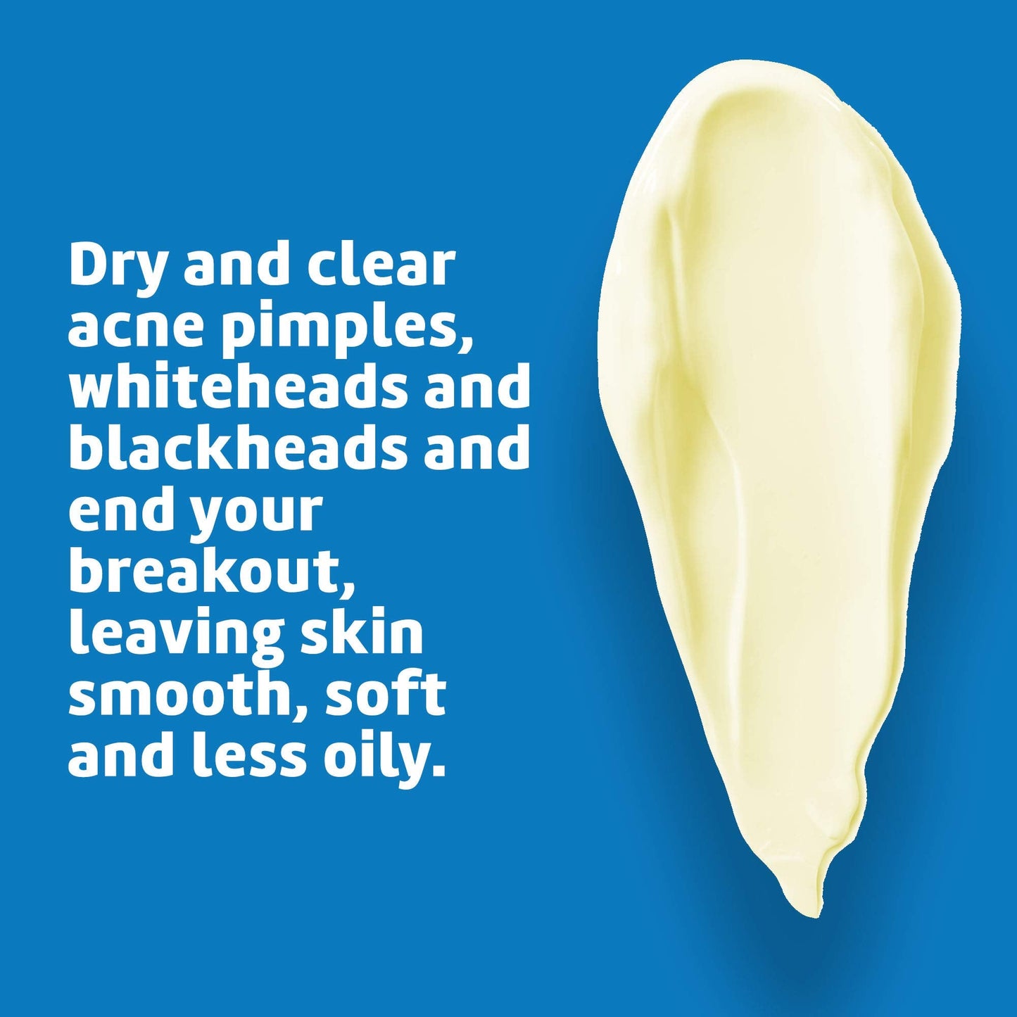 De La Cruz Sulfur Ointment for Cystic & Hormonal Acne - Face & Body Spot Treatment Mask, 10-Min Daily Use, 2.6 oz Tube