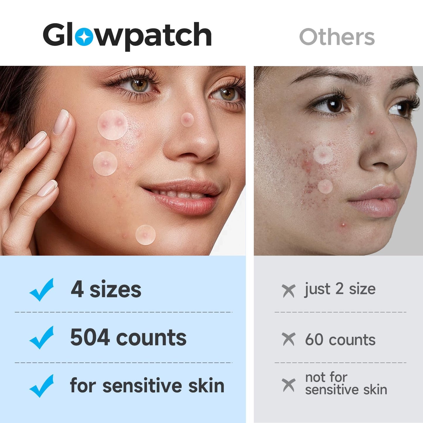 Glowpatch Pimple Patches for Face – 504 Hydrocolloid Acne Spots, 4 Sizes, Clear Zit & Blemish Stickers, FSA Eligible Bulk