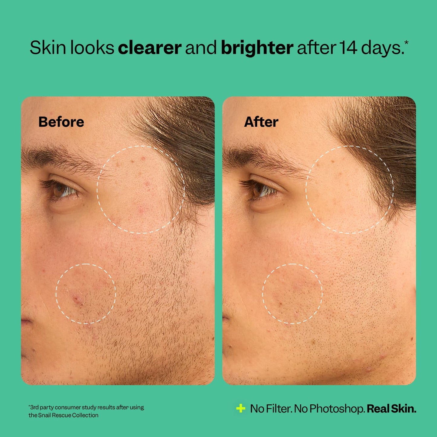 Peach Slices Snail Rescue Blemish Toner – 95% Snail Mucin, Pore Cleansing, Hydrating & Balancing, CICA, Hyaluronic Acid, 4.05 oz