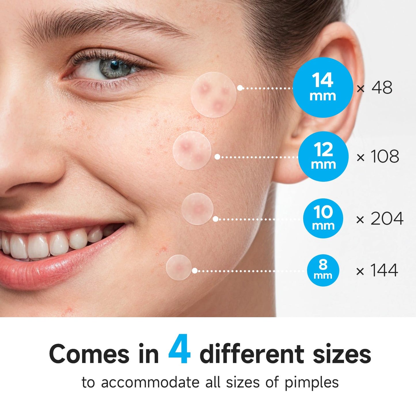 Glowpatch Pimple Patches for Face – 504 Hydrocolloid Acne Spots, 4 Sizes, Clear Zit & Blemish Stickers, FSA Eligible Bulk
