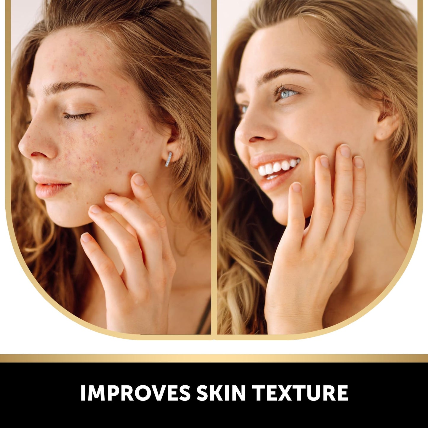 VALITIC Kojic Acid Soap with Vitamin C, Retinol & Turmeric for Dark Spots – Japanese Complex with Collagen, Hyaluronic Acid & Vitamin E, 2 Pack