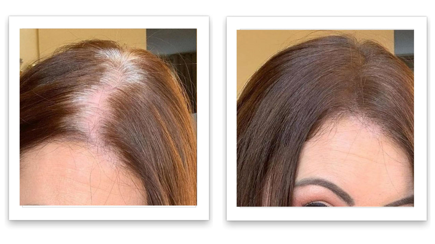 Caboki 10X Volumizing Hair Powder Dark Brown – Covers Bald Spots & Grays, Fills Hairline & Edges, Root Touch-Up for Thinning Hair, Talc-Free''[;[/