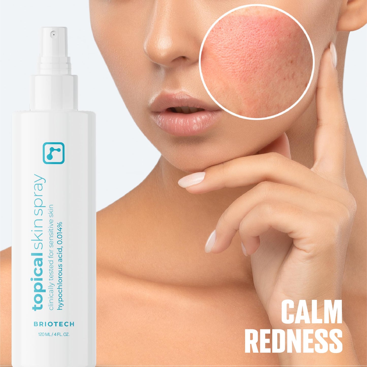 BRIOTECH Hypochlorous Acid Skin Spray – HOCl Facial & Body Mist for Sensitive Skin, Soothes Redness, Irritation, Feet & Scalp, 4 oz