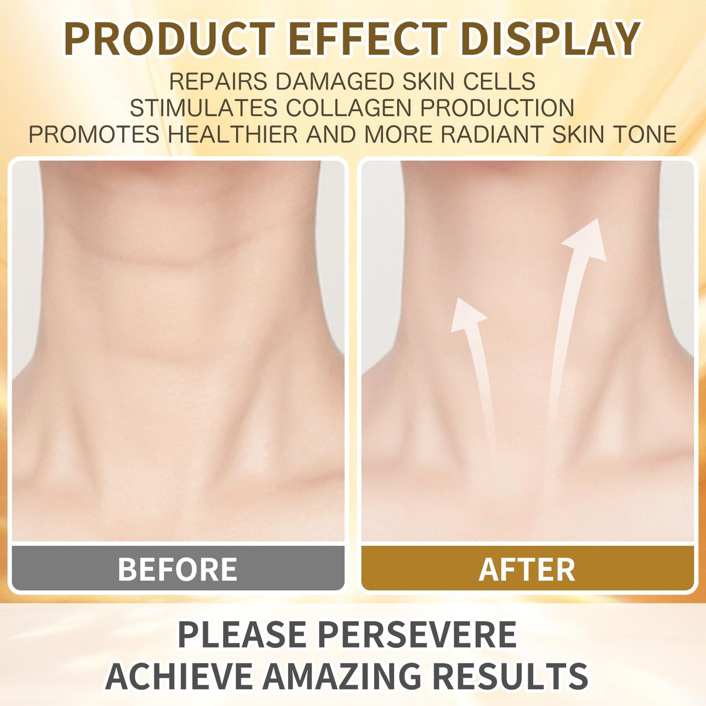 5-in-1 Anti-Aging Neck & Face Firming Cream with Retinol & Collagen – Tightens, Lifts & Moisturizes Skin for Men & Women, 1.7 oz