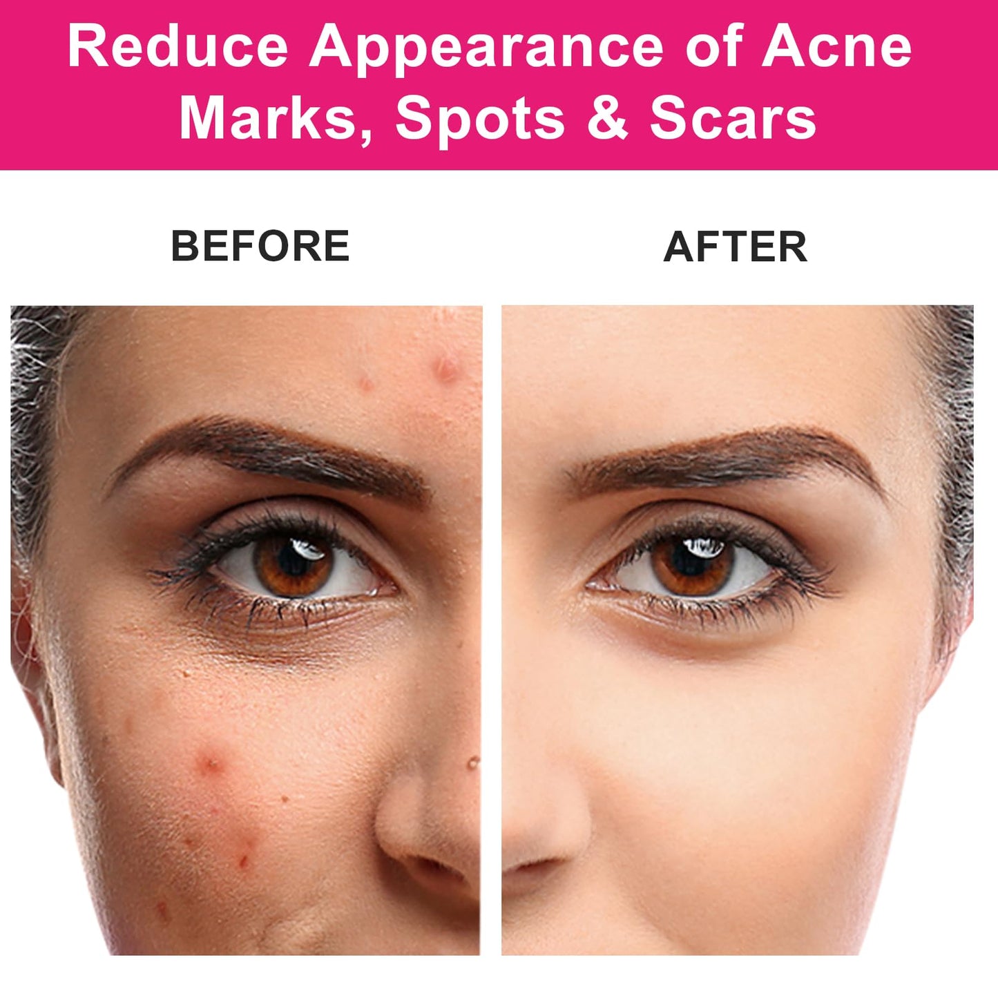 MMPANG Organic Rosehip Seed Oil for Face & Hair, USDA Certified, Cold-Pressed, 100% Pure, Anti-Aging, Acne Scar & Gua Sha Oil, 1oz