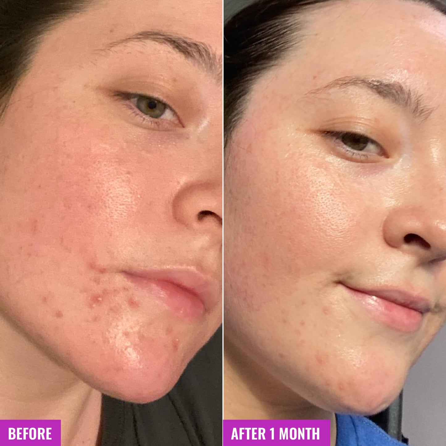 Good Molecules Clarify & Cleanse Bar – Soap-Free with Salicylic Acid (BHA) for Skin Tone, Face & Body Cleanser, Skincare for All Skin Types