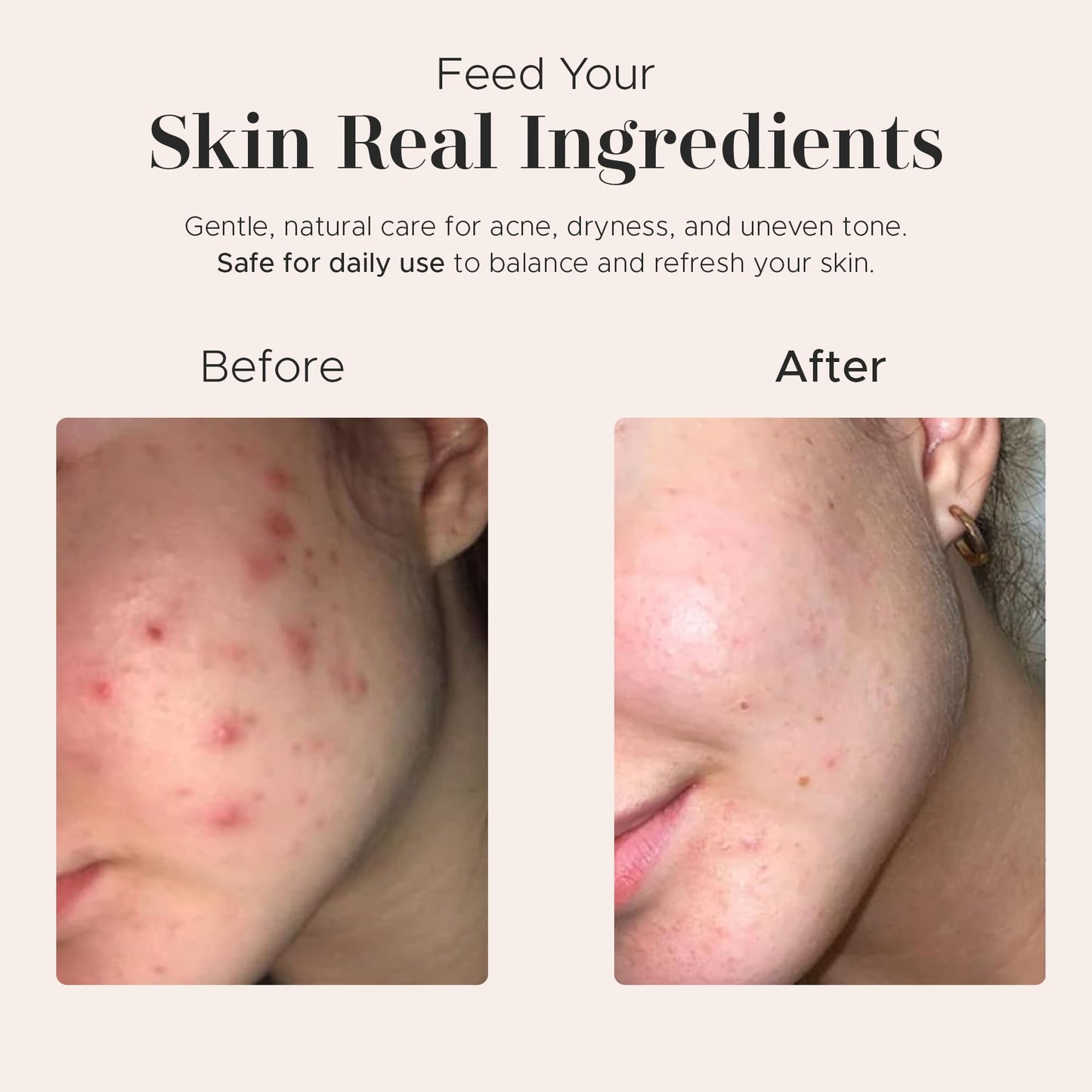 era of nature Best Raw ORGANIC AFRICAN BLACK SOAP, for Dry Skin and Skin Conditions. Pure & Natural Ingredients, Imported From Ghana - 8oz