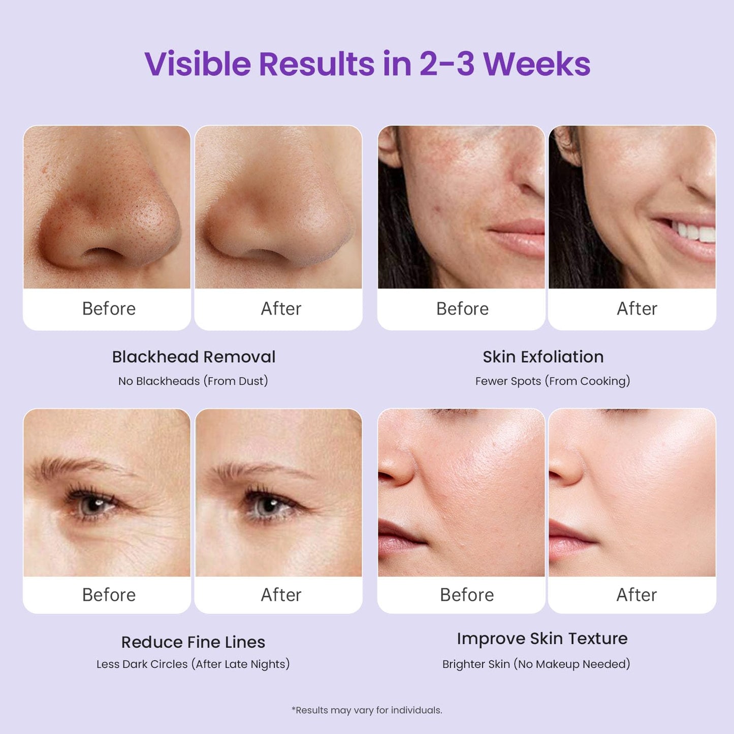 UNOISETION Diamond Microdermabrasion Machine Professional, 3 in 1 Dermabrasion Facial Peeling Skin Care Device for Salon Personal Home Use