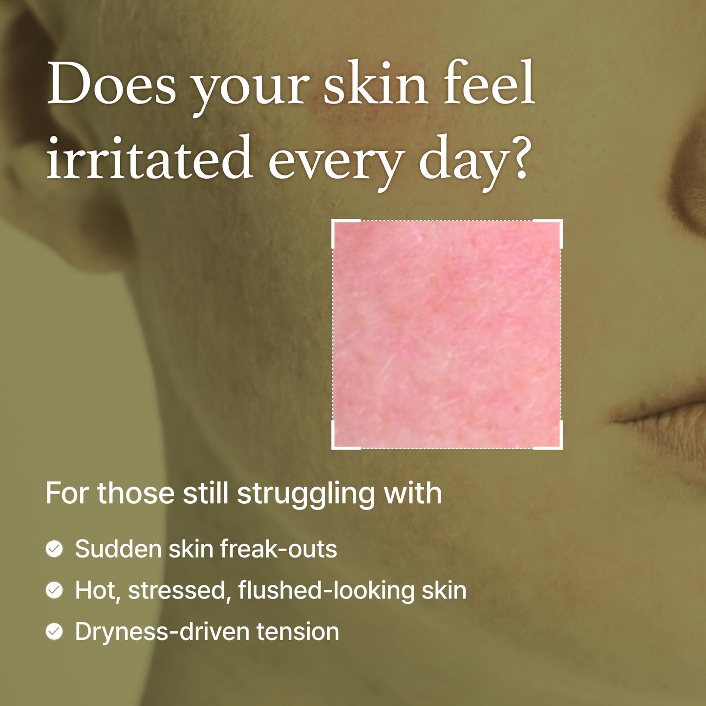 I'm From Mugwort Essence - Vegan Korean Toner for Sensitive Skin, Redness Relief & Hydration, Soothing & Refreshing, 5.4 fl oz