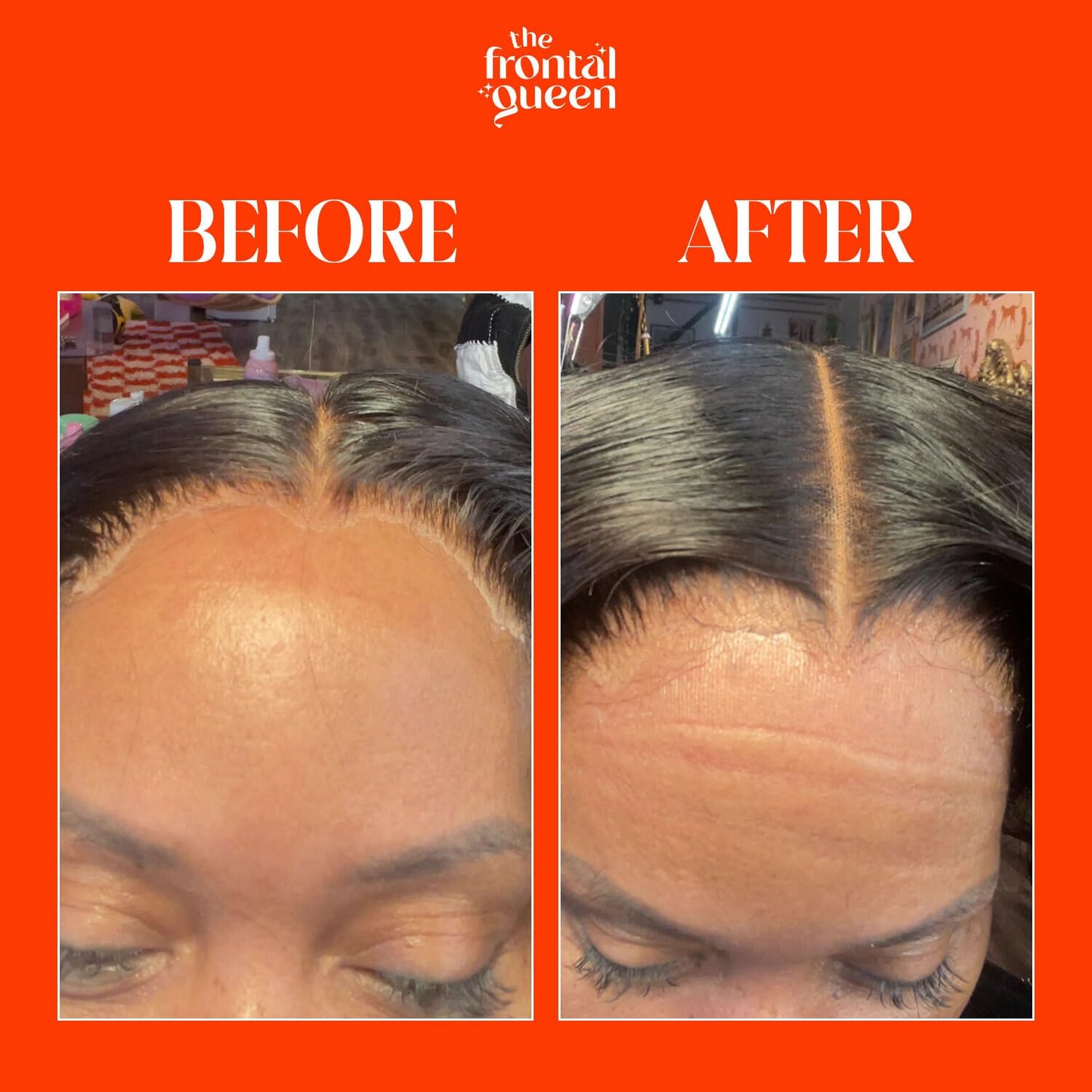 The Frontal Queen Ashy Lace Melting Spray – Extra Hold Adhesive for Lace Wigs, No Residue, Long-Lasting & Safe Formula, 4.2 oz