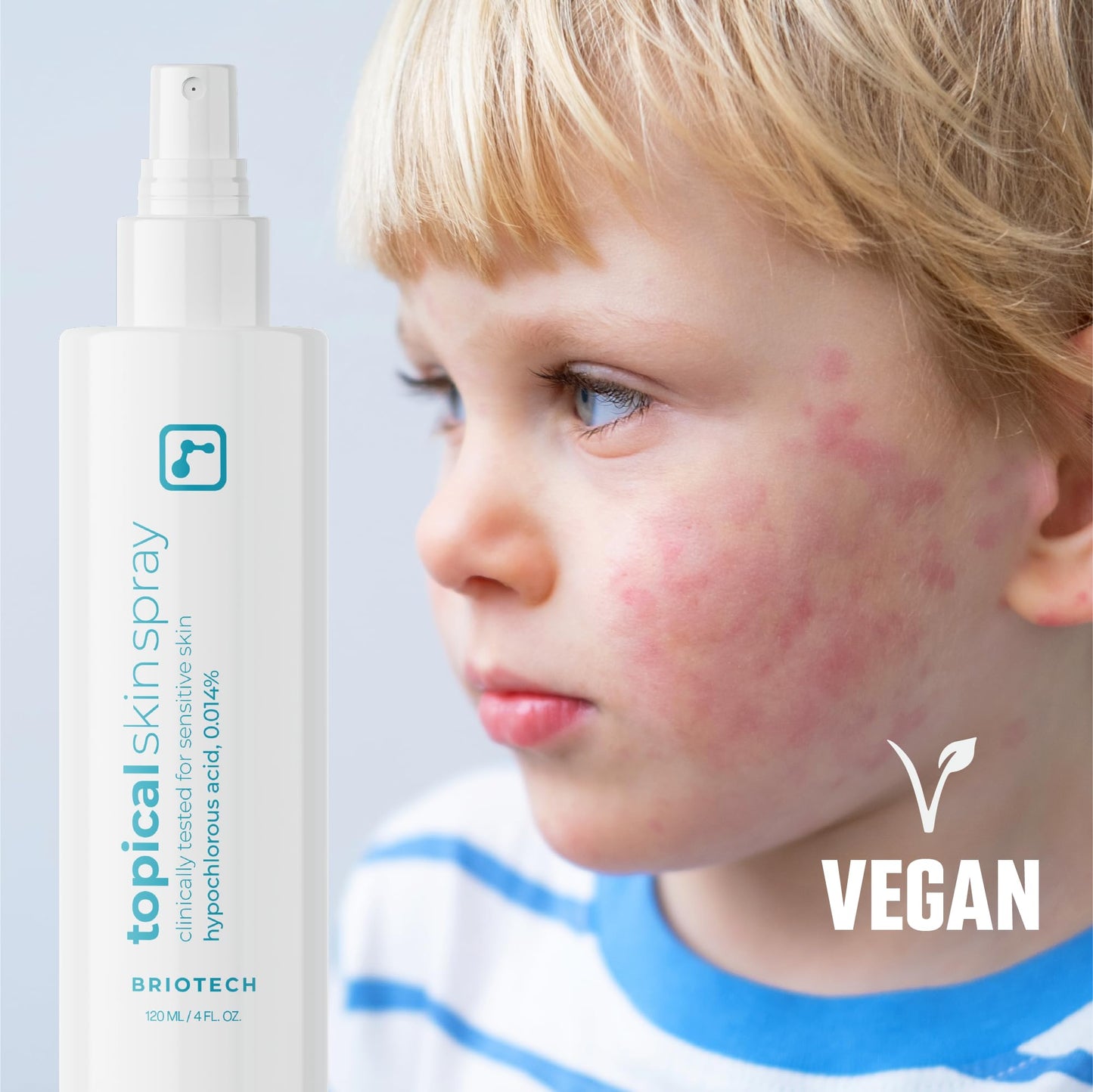 BRIOTECH Hypochlorous Acid Skin Spray – Soothes Redness, Irritation & Sensitive Skin, Facial & Full Body Mist, Foot & Scalp Relief, 8 oz