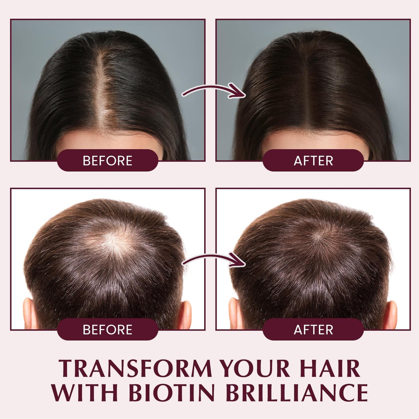 Herbal Essences Hair Growth Shampoo with Biotin, Rosemary & Rice Water – Strengthens Roots, Reduces Thinning & Hair Loss, for Men & Women, 10.5 Fl Oz