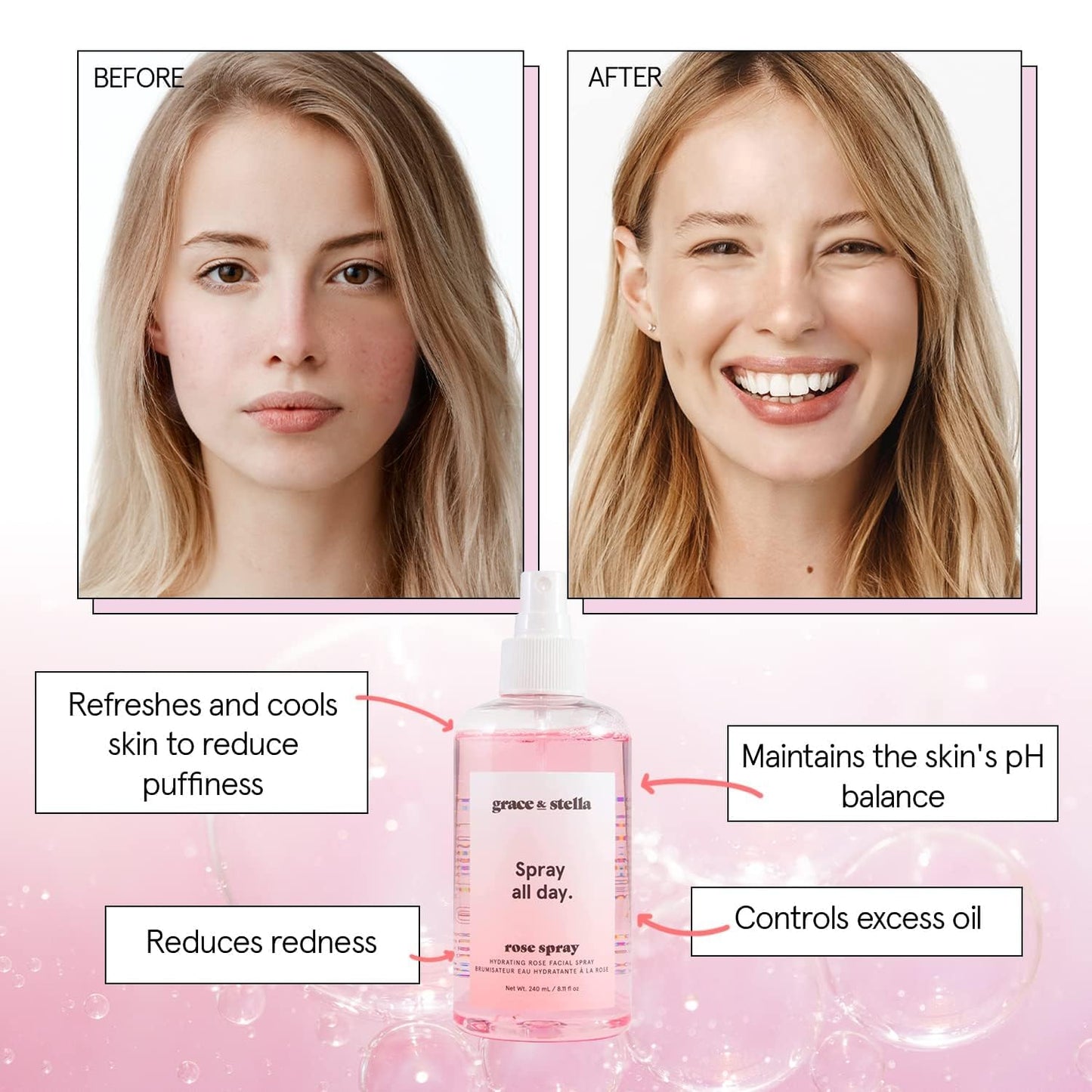grace & stella Rose Water Facial Spray (240ml) – Award-Winning Hydrating Toner & Mist – Vegan Rosewater Hydrosol for Glowing, Refreshed Skin
