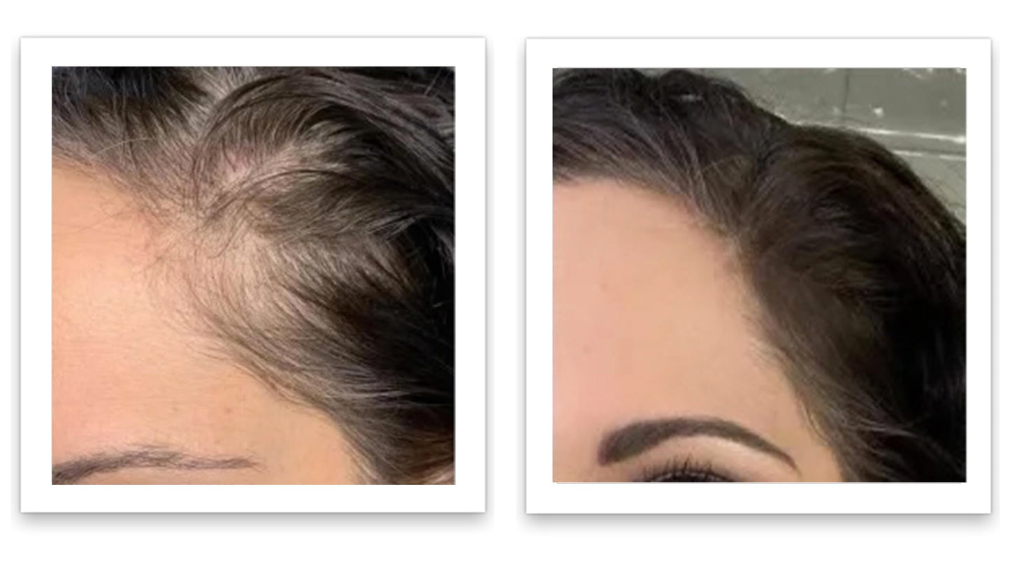 Caboki 10X Volumizing Hair Powder Dark Brown – Covers Bald Spots & Grays, Fills Hairline & Edges, Root Touch-Up for Thinning Hair, Talc-Free''[;[/