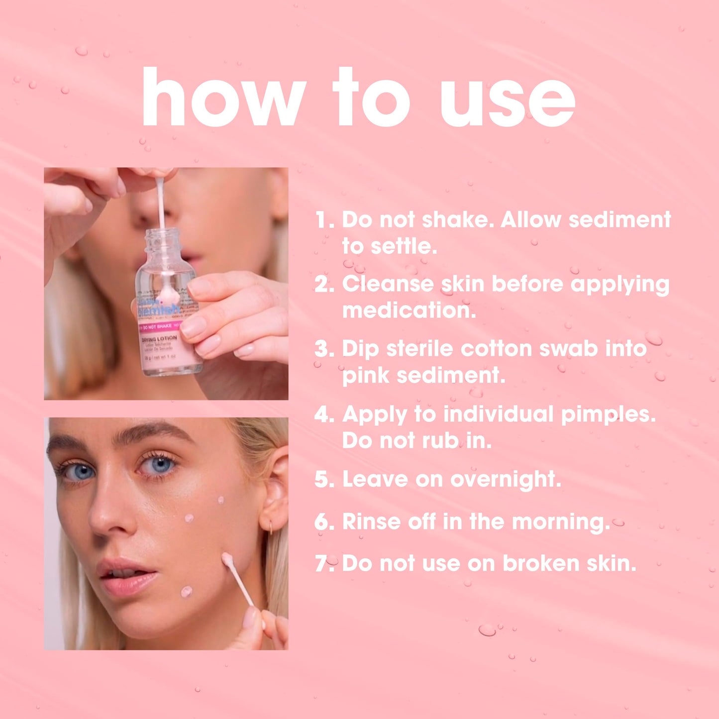 Bye Bye Blemish Acne Drying Lotion, Reduce Pimples Overnight 1oz, 1-Pack